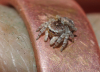 Attulus saltator female on ring