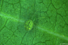 Nigma walckenaeri under a Leica light microscope